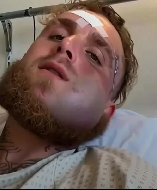 Jake Paul's broken jaw Blank Meme Template