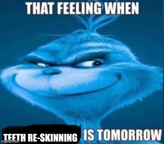 25+ best teeth re-skinning memes | TEETH RE-SKINNING | image tagged in that feeling when x is tomorrow,teeth re-skinning | made w/ Imgflip meme maker