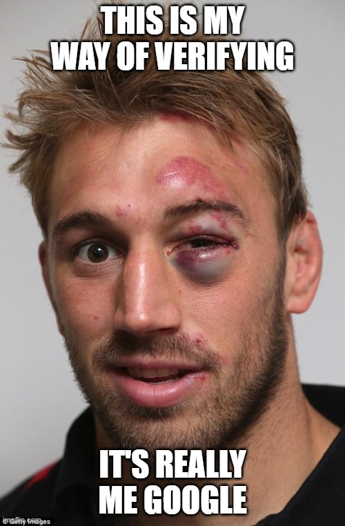 Verifying it's really me Google | THIS IS MY WAY OF VERIFYING; IT'S REALLY ME GOOGLE | image tagged in black eye,failing up,spying,selling your data,google punch | made w/ Imgflip meme maker