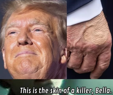 Skin issues of a killer Blank Meme Template