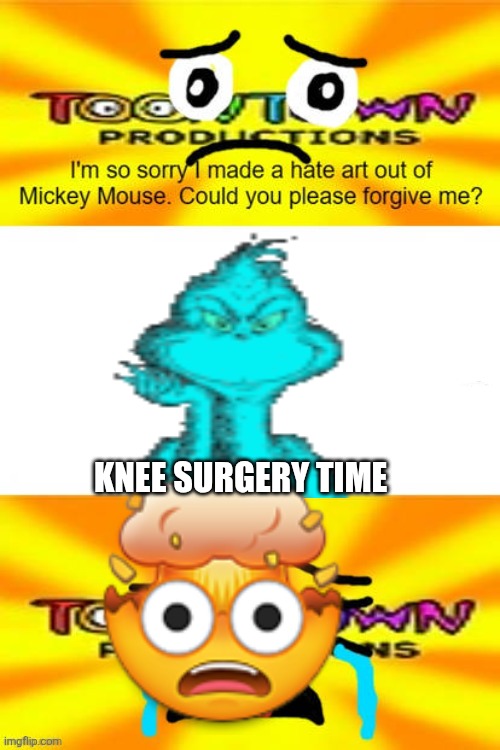 KNEE SURGERY!!!!!!!!!!!!! | KNEE SURGERY TIME | image tagged in knee surgery | made w/ Imgflip meme maker