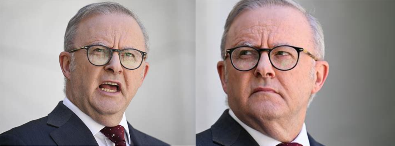 Anthony Albanese Blank Meme Template