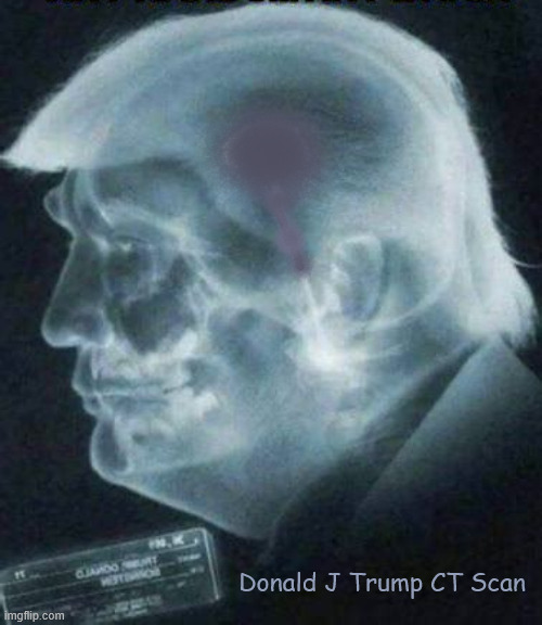 Trump CT Scan  Shows nothing | Donald J Trump CT Scan | image tagged in trump ct scan  shows nothing | made w/ Imgflip meme maker