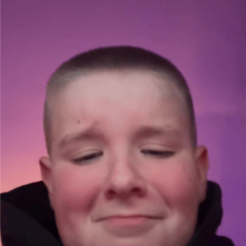 Bald Blank Meme Template