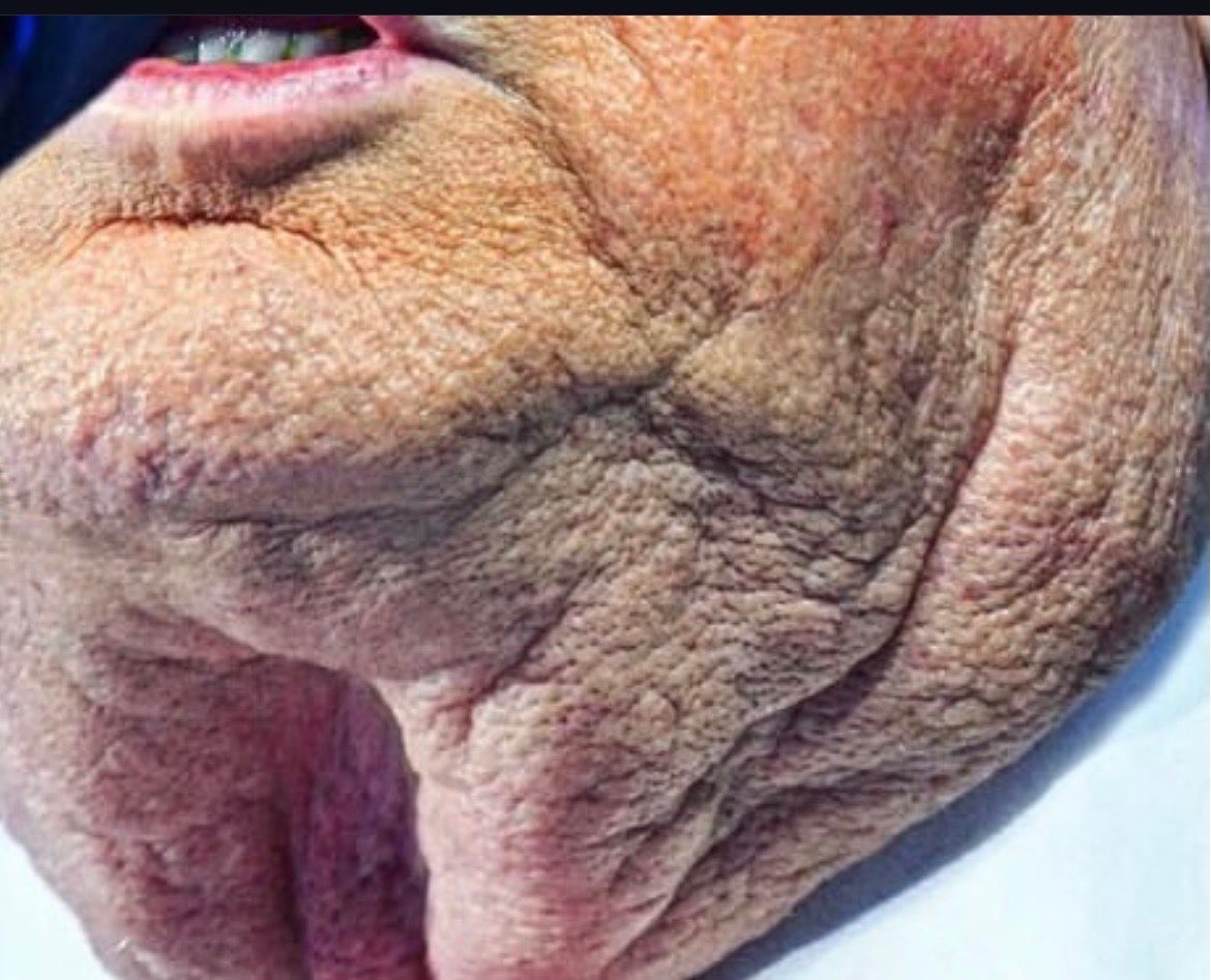 High Quality Trump Skin Blank Meme Template