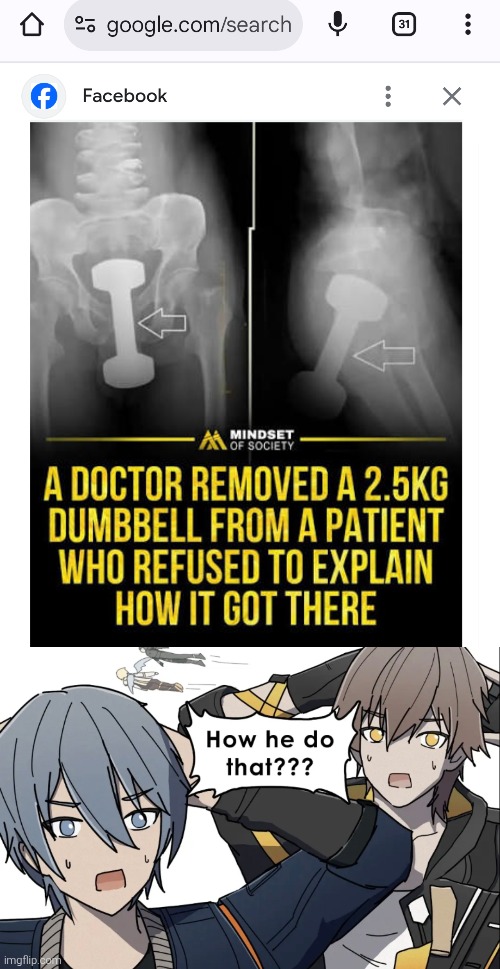 Anyone has a idea how this happened? | image tagged in news,dumbbell,wtf | made w/ Imgflip meme maker