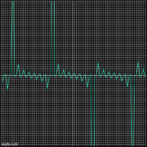 y=tan(x) with snaptointegers turned on | made w/ Imgflip meme maker
