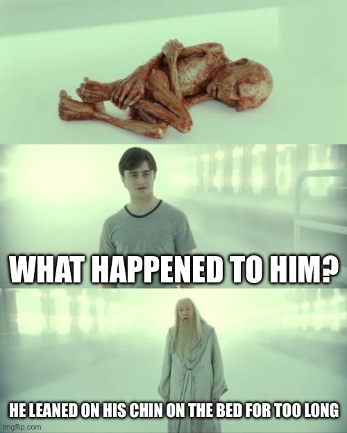 Dead Baby Voldemort / What Happened To Him | WHAT HAPPENED TO HIM? HE LEANED ON HIS CHIN ON THE BED FOR TOO LONG | image tagged in dead baby voldemort / what happened to him | made w/ Imgflip meme maker