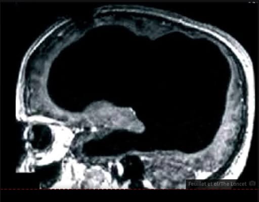 grump Blank Meme Template