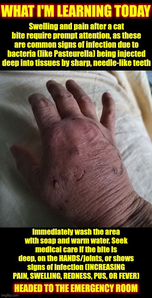 I'm Learning Something New About CATS Every Single Day! | WHAT I'M LEARNING TODAY; Swelling and pain after a cat bite require prompt attention, as these are common signs of infection due to bacteria (like Pasteurella) being injected deep into tissues by sharp, needle-like teeth; Immediately wash the area with soap and warm water. Seek medical care if the bite is deep, on the HANDS/joints, or shows signs of infection (INCREASING PAIN, SWELLING, REDNESS, PUS, OR FEVER); HEADED TO THE EMERGENCY ROOM | image tagged in memes,emergency alert,cat bites,infection,freakin cats,knowledge is power | made w/ Imgflip meme maker