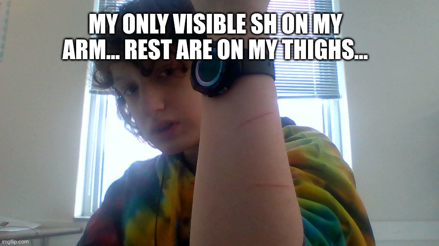 I Can't Even Really Move My Legs Without Pain.... Feels Nice Tho... (Yes I Have A Plan...) | MY ONLY VISIBLE SH ON MY ARM... REST ARE ON MY THIGHS... | made w/ Imgflip meme maker