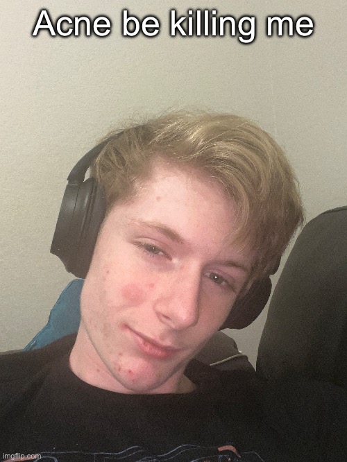 I’ll add the man face later maybe | Acne be killing me | made w/ Imgflip meme maker