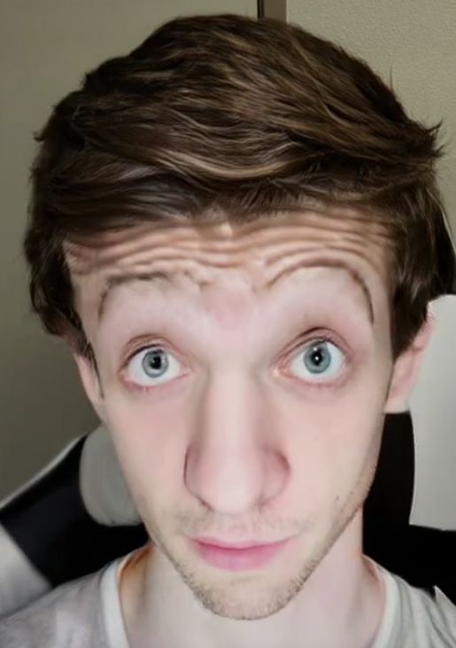 Shocked Blank Meme Template