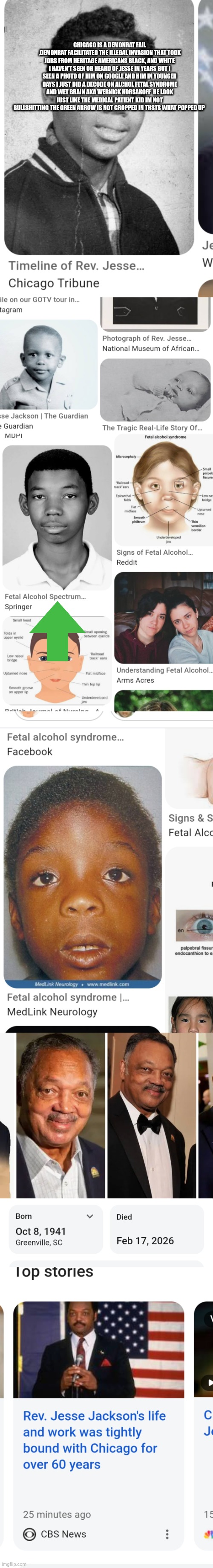 JESSE Jackson posthumously decoded his parent(s) were alcoholics | CHICAGO IS A DEMONRAT FAIL ,DEMONRAT FACILITATED THE ILLEGAL INVASION THAT TOOK JOBS FROM HERITAGE AMERICANS BLACK, AND WHITE I HAVEN'T SEEN OR HEARD OF JESSE IN YEARS BUT I SEEN A PHOTO OF HIM ON GOOGLE AND HIM IN YOUNGER DAYS I JUST DID A DECODE ON ALCHOL FETAL SYNDROME AND WET BRAIN AKA WERNICK KORSAKOFF  HE LOOK JUST LIKE THE MEDICAL PATIENT KID IM NOT BULLSHITTING THE GREEN ARROW IS NOT CROPPED IN THSTS WHAT POPPED UP | image tagged in wtf,lookslike | made w/ Imgflip meme maker