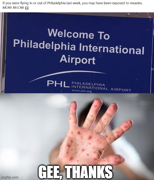 Measles | GEE, THANKS | image tagged in child's hand with measles - thank you anti-vaxxers | made w/ Imgflip meme maker