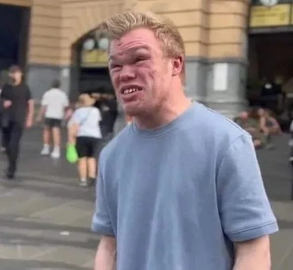 Creepy Irwin Blank Meme Template