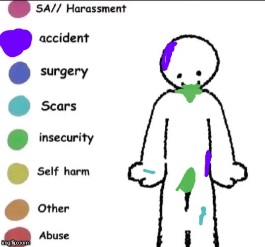 it was a car accident, imao, hit my head and waist | image tagged in pain chart | made w/ Imgflip meme maker