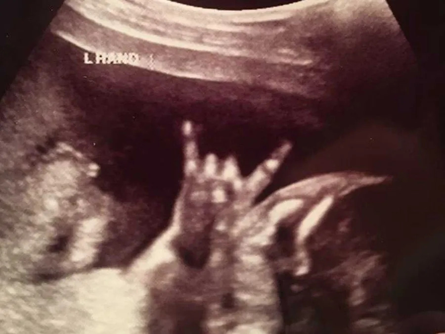 Cool ecography Blank Meme Template