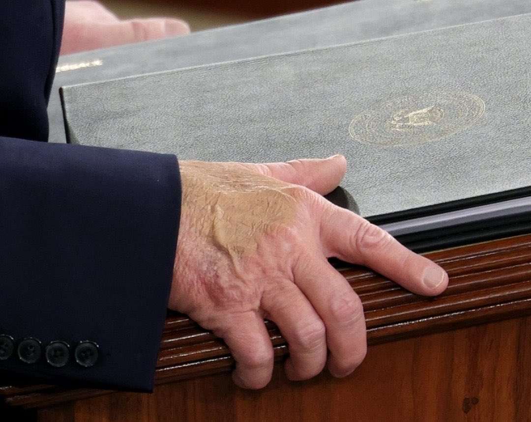 Donald Trump hands decaying State of the Union Blank Meme Template