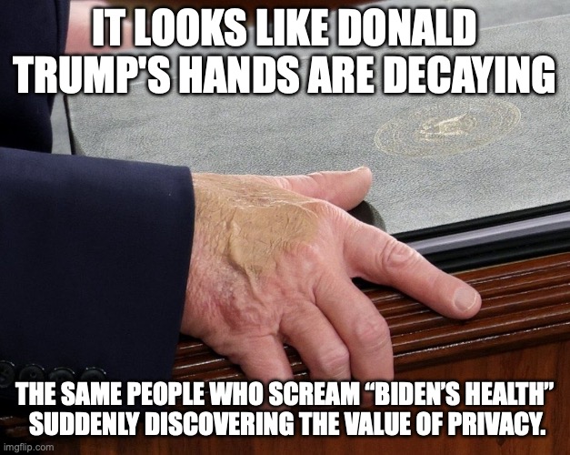 Zombie State of the Union Address | IT LOOKS LIKE DONALD TRUMP'S HANDS ARE DECAYING; THE SAME PEOPLE WHO SCREAM “BIDEN’S HEALTH”
 SUDDENLY DISCOVERING THE VALUE OF PRIVACY. | image tagged in donald trump hands decaying state of the union,donald trump,walking dead zombie,state of the union,healthcare | made w/ Imgflip meme maker