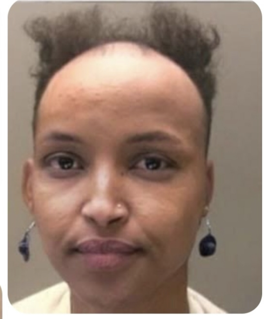 baldy imar Blank Meme Template