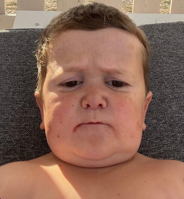 Accidental Open Cam Blank Meme Template