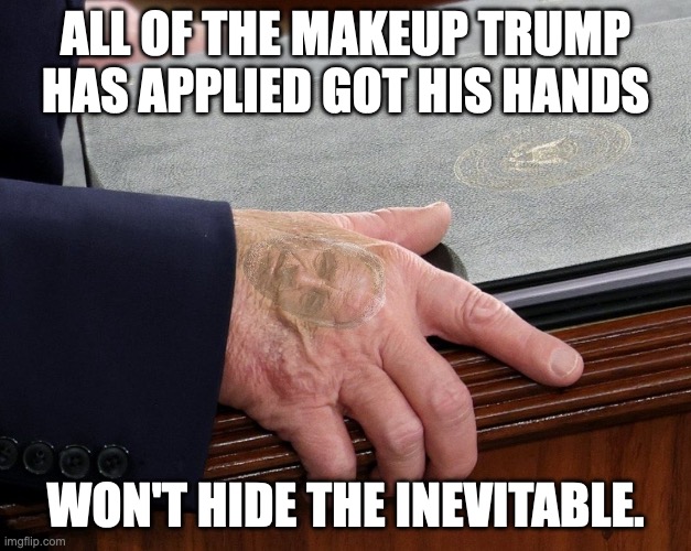 That lesion looks caused by the Epstein-Barr Virus | ALL OF THE MAKEUP TRUMP HAS APPLIED GOT HIS HANDS; WON'T HIDE THE INEVITABLE. | image tagged in donald trump hands decaying state of the union,donald trump,jeffrey epstein,death knocking at the door,pedophiles | made w/ Imgflip meme maker