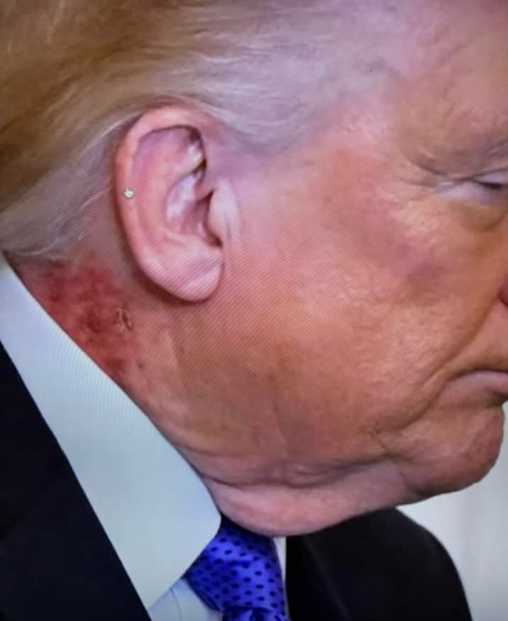 neck, stain Blank Meme Template