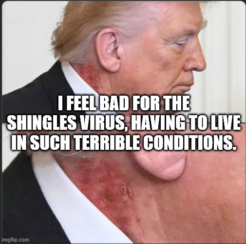 Poor virus... | I FEEL BAD FOR THE SHINGLES VIRUS, HAVING TO LIVE IN SUCH TERRIBLE CONDITIONS. | image tagged in donald trump,maga,potus,republicans,disease | made w/ Imgflip meme maker