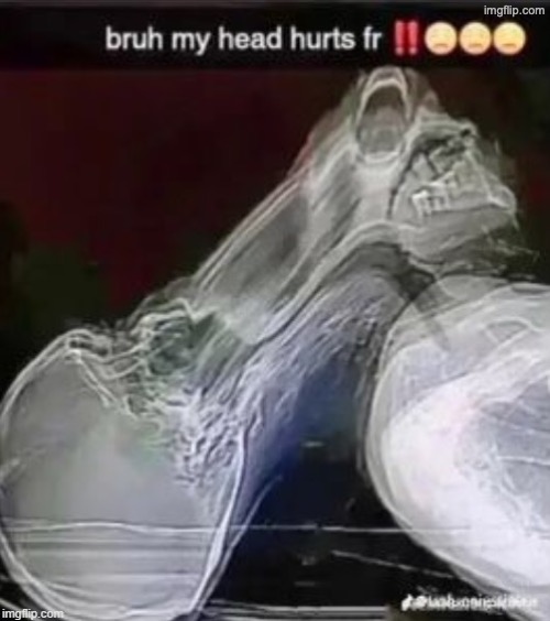 My head hurts | image tagged in my head hurts | made w/ Imgflip meme maker