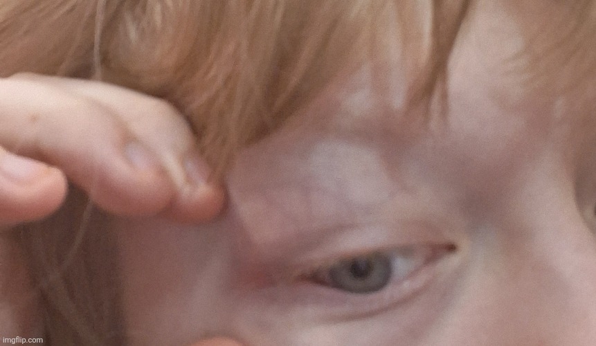 I have a black eye but it's only at the corner | made w/ Imgflip meme maker