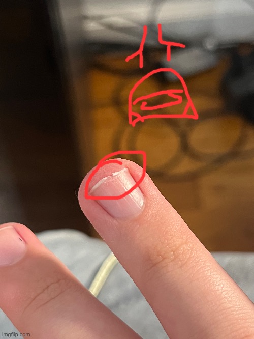 Over filed my nail :( | made w/ Imgflip meme maker