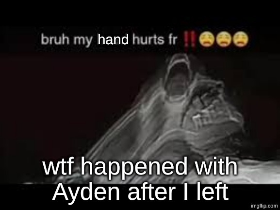 the sev guy idk how to spell it | wtf happened with Ayden after I left | image tagged in my hand hurts fr | made w/ Imgflip meme maker