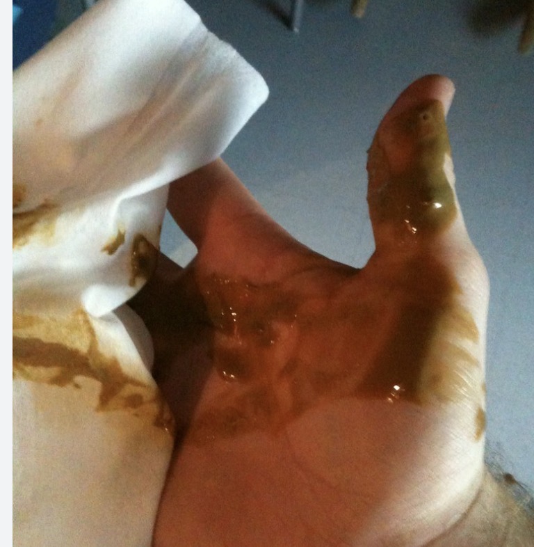 Dirty hand Blank Meme Template