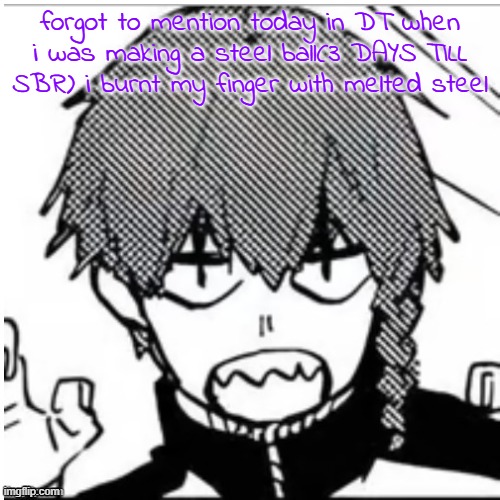 me hurties :( | forgot to mention today in DT when i was making a steel ball(3 DAYS TILL SBR) i burnt my finger with melted steel | image tagged in mr silly shark | made w/ Imgflip meme maker