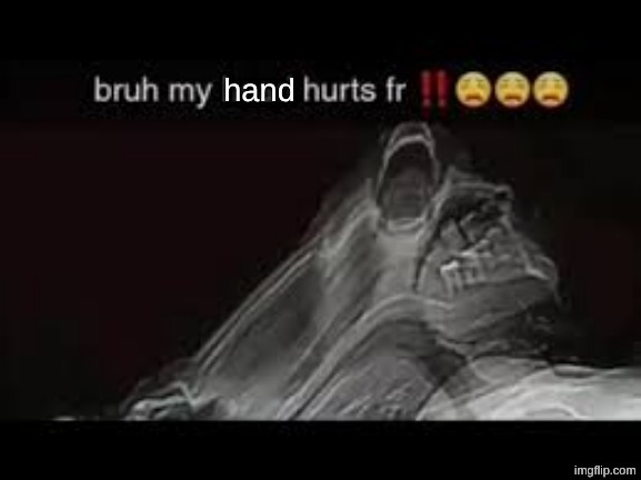 my hand hurts fr | <!DOCTYPE html>
<html>

<head>
    <meta charset="utf-8">
    <meta http-equiv="X-UA-Compatible" content="IE=edge">
    <title>gd</title>
    <meta name="description" content="yuh">
    <meta name="viewport" content="width=device-width, initial-scale=1">
    <style>
        body {
            margin: 0;
            background: #111;
            overflow: hidden;
        }

        canvas {
            display: block;
            margin: auto;
            background: #000099;
        }
    </style>
</head>

<body>
    <canvas id="game"></canvas>

    <script>
        /* Canvas Setup */
        const canvas = document.getElementById("game");
        const ctx = canvas.getContext("2d");
        canvas.width = window.innerWidth;
        canvas.height = window.innerHeight;

        window.addEventListener("resize", () => {
            canvas.width = window.innerWidth;
            canvas.height = window.innerHeight;
        });

        /* Global Variables */
        const TILE_SIZE = 40;
        const SPIKE_HITBOX_SIZE = TILE_SIZE / 2;

        let cameraX = 0;

        let paused = false;
        let input = { pressed: false };
        let wasPressed = false;
        let jumpBuffered = false;
        let activatedPads = new Set();
        let activatedOrbs = new Set();
        let activatedPortals = new Set();
        let levelCompleted = false;

        let player = {
            x: 0,
            y: 0,
            prevX: 0,
            width: TILE_SIZE,
            height: TILE_SIZE,
            velY: 0,
            gravity: 0.6,
            gravityState: 1, // 1 = normal, -1 = inverted
            jumpForce: -10.5,
            grounded: false,
            speed: 5.5,
            rotation: 0,
            rotationSpeed: Math.PI / 30,
            gamemode: "cube"
        };

        /* Level Data */
        const TILE_TYPES = {
            "#": { solid: true },

            "A": { hazard: true },
            "^": { hazard: true },
            "V": { hazard: true },
            "v": { hazard: true },
            "X": { hazard: true },

            "y": { orb: true },
            "m": { orb: true },
            "r": { orb: true },
            "b": { orb: true },

            "Y": { pad: true },
            "M": { pad: true },
            "R": { pad: true },
            "B": { pad: true },

            ")": { portal: true, gravity: -1 },
            "(": { portal: true, gravity: 1 },
            "]": { portal: true, gamemode: "cube" },
            "[": { portal: true, gamemode: "ship" },
            "}": { portal: true, gamemode: "ball" },
            "{": { portal: true, gamemode: "ufo" },

            "E": { levelEnd: true }
        };

        const levelData = {
            level1: [
                "..............................#...........#.................#..........#........#...................",
                "..............................#...........#.................#..........#........#...................",
                "..............................#...........#.................#..........#........#...................",
                "..............................#...........#.................#..........#........#...................",
                "..............................#...........#.................#..........#........#...................",
                "..............................#...........#.................#..........#........#...................",
                "..............................#...........#.................#..........#........#...................",
                "..............................#...........#.................#..........#........#...................",
                "..............................#...........#.................#..........#........#...................",
                "..............................#...........#.................#..........#........#...................",
                "..............................#...........#.................#..........#............................",
                "..............................#...........#............................#............................",
                "..............................#############............................#............................",
                "................................................................................#...................",
                "........................}...........................{.......#...................#...................",
                "......................#...........^.......y....y.....Y......#...................#...................",
                "..................#...#..##########..................#......#..........#........#...................",
                "*......^A.....#...#...#..#........#AAAAAAAAAAAAAAAAAA#......#..........#........#...................",
                "###############XXX#XXX##############################################################################",
                "####################################################################################################"
            ]
        };

        const music = new Audio("SuperUltraMDK.mp3");
        music.loop = true;
        music.volume = 0.5;

        /* Level Helpers */
        function getTile(col, row) {
            if (
                row < 0 ||
                row >= levelData.level1.length ||
                col < 0 ||
                col >= levelData.level1[0].length
            ) return null;

            return levelData.level1[row][col];
        }

        function tileKey(col, row) {
            return col + "," + row;
        }

        function findStart() {
            for (let row = 0; row < levelData.level1.length; row++) {
                for (let col = 0; col < levelData.level1[row].length; col++) {
                    if (levelData.level1[row][col] === "*") {
                        player.x = col * TILE_SIZE;
                        player.y = row * TILE_SIZE;
                    }
                }
            }
        }

        function isSolid(tile) {
            return TILE_TYPES[tile]?.solid;
        }

        function isHazard(tile) {
            return TILE_TYPES[tile]?.hazard;
        }

        function isOrb(tile) {
            return TILE_TYPES[tile]?.orb;
        }

        function isPad(tile) {
            return TILE_TYPES[tile]?.pad;
        }

        function isPortal(tile) {
            return TILE_TYPES[tile]?.portal;
        }

        function isLevelEnd(tile) {
            return TILE_TYPES[tile]?.levelEnd;
        }

        /* Input Handling */
        function setupInput() {
            window.addEventListener("keydown", (e) => {
                if (e.code === "Space" || e.code === "ArrowUp") {
                    input.pressed = true;
                }
            });

            window.addEventListener("keyup", (e) => {
                if (e.code === "Space" || e.code === "ArrowUp") {
                    input.pressed = false;
                }
            });

            window.addEventListener("mousedown", () => input.pressed = true);
            window.addEventListener("mouseup", () => input.pressed = false);

            window.addEventListener("touchstart", (e) => {
                e.preventDefault();
                input.pressed = true;
            }, { passive: false });

            window.addEventListener("touchend", () => input.pressed = false);

            window.addEventListener("keydown", (e) => {

                if (e.code === "KeyP" || e.code === "Escape") {
                    togglePause();
                }

                if (e.code === "Space" || e.code === "ArrowUp") {
                    input.pressed = true;
                    music.play().catch(() => { });
                }
            });
        }

        /* Physics and Movement */
        function applyPhysics() {
            const justPressed = input.pressed && !wasPressed;
            wasPressed = input.pressed;

            if (justPressed && !player.grounded) {
                jumpBuffered = true;
            }

            if (player.gamemode === "cube") {
                if (player.grounded && input.pressed) {
                    player.velY = player.jumpForce * player.gravityState;
                    jumpBuffered = false;
                }
            } else if (player.gamemode === "ball") {
                if (justPressed && player.grounded) {
                    player.gravityState *= -1;
                    player.velY = 0;
                }
            } else if (player.gamemode === "ufo") {
                if (justPressed) {
                    player.velY = player.jumpForce * player.gravityState;
                    jumpBuffered = false;
                    player.grounded = false;
                }
            }

            player.prevX = player.x;
            player.x += player.speed;

            player.velY += player.gravity * player.gravityState;
            player.y += player.velY;

            player.grounded = false;

            if (player.gamemode === "cube") {
                if (!player.grounded) {
                    player.rotation += player.rotationSpeed * player.gravityState;
                }
            } else if (player.gamemode === "ball") {
                player.rotation += (player.speed / TILE_SIZE) * 2 * Math.PI * player.gravityState;
            } else if (player.gamemode === "ufo") {
                player.rotation = 0;
            }
        }

        /* Collision Handling */
        function handleCollisions() {

            const leftCol = Math.floor(player.x / TILE_SIZE);
            const rightCol = Math.floor((player.x + player.width - 1) / TILE_SIZE);
            const topRow = Math.floor(player.y / TILE_SIZE);
            const bottomRow = Math.floor((player.y + player.height) / TILE_SIZE);

            for (let row = topRow; row <= bottomRow; row++) {
                for (let col = leftCol; col <= rightCol; col++) {

                    const tile = getTile(col, row);
                    if (!tile) continue;

                    const tileX = col * TILE_SIZE;
                    const tileY = row * TILE_SIZE;

                    if (isSolid(tile)) {

                        if (player.gravityState === 1) {

                            // landing on floor
                            if (player.velY > 0 && player.y + player.height > tileY && player.y < tileY) {
                                player.y = tileY - player.height;
                                player.velY = 0;
                                player.grounded = true;

                                if (player.gamemode === "cube") {
                                    player.rotation = Math.round(player.rotation / (Math.PI / 2)) * (Math.PI / 2);
                                }
                            }

                            // hitting ceiling
                            else if (player.velY < 0 && player.y < tileY + TILE_SIZE) {
                                player.y = tileY + TILE_SIZE;
                                player.velY = 0;
                            }

                        } else {

                            // landing on ceiling
                            if (player.velY < 0 && player.y < tileY + TILE_SIZE && player.y + player.height > tileY + TILE_SIZE) {
                                player.y = tileY + TILE_SIZE;
                                player.velY = 0;
                                player.grounded = true;

                                if (player.gamemode === "cube") {
                                    player.rotation = Math.round(player.rotation / (Math.PI / 2)) * (Math.PI / 2);
                                }
                            }

                            // hitting floor
                            else if (player.velY > 0 && player.y + player.height > tileY) {
                                player.y = tileY - player.height;
                                player.velY = 0;
                            }
                        }
                    }

                    if (isHazard(tile) && checkSpikeCollision(tileX, tileY)) {
                        resetPlayer();
                        console.log("Hit hazard at (" + col + ", " + row + ")");
                    }

                    if (isPad(tile)) {

                        const key = tileKey(col, row);

                        const padHeight = TILE_SIZE / 3;
                        const padX = tileX;
                        const padY = tileY + TILE_SIZE - padHeight;

                        const touching =
                            player.x < padX + TILE_SIZE &&
                            player.x + player.width > padX &&
                            player.y + player.height > padY &&
                            player.y < padY + padHeight;

                        if (touching && !activatedPads.has(key)) {

                            activatedPads.add(key);

                            if (tile === "Y") {
                                player.velY = -15 * player.gravityState;
                            } else if (tile === "M") {
                                player.velY = -10 * player.gravityState;
                            } else if (tile === "R") {
                                player.velY = -20 * player.gravityState;
                            } else if (tile === "B") {
                                player.velY = -5 * player.gravityState;
                                player.gravityState *= -1;
                            }

                            player.grounded = false;
                            return;
                        }

                        if (!touching) {
                            activatedPads.delete(key);
                        }
                    }

                    if (isOrb(tile)) {

                        const key = tileKey(col, row);

                        if (isCollidingWithTile(tileX, tileY, TILE_SIZE)) {

                            if ((input.pressed || jumpBuffered) && !activatedOrbs.has(key)) {

                                activatedOrbs.add(key);

                                if (tile === "y") {
                                    player.velY = player.jumpForce * player.gravityState;
                                } else if (tile === "m") {
                                    player.velY = player.jumpForce * player.gravityState + 5;
                                } else if (tile === "r") {
                                    player.velY = player.jumpForce * player.gravityState - 5;
                                } else if (tile === "b") {
                                    player.velY = -5 * player.gravityState;
                                    player.gravityState *= -1;
                                }

                                jumpBuffered = false;
                            }
                        } else {
                            activatedOrbs.delete(key);
                        }
                    }

                    if (isPortal(tile)) {
                        const key = tileKey(col, row);

                        if (isCollidingWithTile(tileX, tileY, TILE_SIZE)) {
                            if (!activatedPortals.has(key)) {
                                activatedPortals.add(key);
                                const portal = TILE_TYPES[tile];

                                if (portal.gravity !== undefined) {
                                    player.gravityState = portal.gravity;
                                }

                                if (portal.gamemode) {
                                    player.gamemode = portal.gamemode;
                                }
                            }
                        } else {
                            activatedPortals.delete(key);
                        }
                    }

                    if (isLevelEnd(tile)) {
                        const key = tileKey(col, row);

                        if (isCollidingWithTile(tileX, tileY, TILE_SIZE)) {

                            if ((input.pressed || jumpBuffered) && !activatedOrbs.has(key)) {
                                jumpBuffered = false;
                                completeLevel();
                            }
                        } else {
                            activatedOrbs.delete(key);
                        }
                    }
                }
            }
        }

        function checkSpikeCollision(tileX, tileY) {
            const hitboxX = tileX + (TILE_SIZE - SPIKE_HITBOX_SIZE) / 2;
            const hitboxY = tileY + (TILE_SIZE - SPIKE_HITBOX_SIZE) / 2;

            return player.x < hitboxX + SPIKE_HITBOX_SIZE &&
                player.x + player.width > hitboxX &&
                player.y < hitboxY + SPIKE_HITBOX_SIZE &&
                player.y + player.height > hitboxY;
        }

        function isCollidingWithTile(tileX, tileY, tileSize) {
            return player.x < tileX + tileSize &&
                player.x + player.width > tileX &&
                player.y < tileY + tileSize &&
                player.y + player.height > tileY;
        }

        function checkBlockCrush() {

            const col = Math.floor((player.x + player.width / 2) / TILE_SIZE);
            const row = Math.floor((player.y + player.height / 2) / TILE_SIZE);

            const tile = getTile(col, row);

            if (isSolid(tile)) {
                resetPlayer();
                console.log("Crushed inside block at (" + col + ", " + row + ")");
            }
        }

        /* Camera, Progress Bar, & Rendering*/
        function updateCamera() {
            const targetX = player.x - canvas.width / 4;
            if (targetX > cameraX) {
                cameraX += (targetX - cameraX) * 0.1;
            }
        }

        function getProgress() {
            const levelWidth = levelData.level1[0].length * TILE_SIZE;
            return Math.min(player.x / levelWidth, 1);
        }

        function drawProgressBar() {
            const progress = getProgress();

            const barWidth = canvas.width * 0.6;
            const barHeight = 10;

            const x = (canvas.width - barWidth) / 2;
            const y = 20;

            // Background
            ctx.fillStyle = "rgba(255,255,255,0.2)";
            ctx.fillRect(x, y, barWidth, barHeight);

            // Fill
            ctx.fillStyle = "lime";
            ctx.fillRect(x, y, barWidth * progress, barHeight);

            // Outline
            ctx.strokeStyle = "white";
            ctx.lineWidth = 2;
            ctx.strokeRect(x, y, barWidth, barHeight);

            ctx.fillStyle = "white";
            ctx.font = "16px Arial";
            ctx.textAlign = "center";
            ctx.fillText(Math.floor(progress * 100) + "%", canvas.width / 2, y + 25);
        }

        function render() {
            ctx.clearRect(0, 0, canvas.width, canvas.height);

            drawProgressBar();
            drawLevel();
            drawPlayer();

            if (levelCompleted) {
                ctx.fillStyle = "rgba(0,0,0,0.5)";
                ctx.fillRect(0, 0, canvas.width, canvas.height);

                ctx.fillStyle = "lime";
                ctx.font = "60px Arial";
                ctx.textAlign = "center";

                ctx.fillText("Level Complete!", canvas.width / 2, canvas.height / 2);
            }

            if (paused && !levelCompleted) {

                ctx.fillStyle = "rgba(0,0,0,0.5)";
                ctx.fillRect(0, 0, canvas.width, canvas.height);

                ctx.fillStyle = "white";
                ctx.font = "48px Arial";
                ctx.textAlign = "center";

                ctx.fillText("Game Paused", canvas.width / 2, canvas.height / 2);
            }
        }

        /* Drawing Functions */
        function drawLevel() {

            const startCol = Math.floor(cameraX / TILE_SIZE);
            const endCol = startCol + Math.ceil(canvas.width / TILE_SIZE) + 1;

            for (let row = 0; row < levelData.level1.length; row++) {

                for (let col = startCol; col < endCol; col++) {

                    const tile = getTile(col, row);
                    if (!tile) continue;

                    const x = col * TILE_SIZE - cameraX;
                    const y = row * TILE_SIZE;

                    if (isSolid(tile)) {
                        drawSolid(tile, x, y);
                    }

                    if (isHazard(tile)) {
                        drawHazard(tile, x, y);
                    }

                    if (isOrb(tile)) {
                        drawOrb(tile, x, y);
                    }

                    if (isPad(tile)) {
                        drawPad(tile, x, y);
                    }

                    if (isPortal(tile)) {
                        drawPortal(tile, x, y);
                    }

                    if (isLevelEnd(tile)) {
                        drawEnd(tile, x, y);
                    }
                }
            }
        }

        function drawPlayer() {
            const drawX = player.x - cameraX + player.width / 2;
            const drawY = player.y + player.height / 2;

            ctx.save();
            ctx.translate(drawX, drawY);
            if (player.gamemode === "cube") {
                ctx.rotate(player.rotation);

                ctx.fillStyle = "lime";
                ctx.fillRect(-player.width / 2, -player.height / 2, player.width, player.height);
            } else if (player.gamemode === "ball") {
                ctx.rotate(player.rotation);

                ctx.fillStyle = "red";
                ctx.beginPath();
                const size = TILE_SIZE / 2;
                ctx.moveTo(0, size);
                ctx.lineTo(0, size / 2);
                ctx.lineTo(size / 1.5, size / 1.5);
                ctx.lineTo(size / 3, size / 3);
                ctx.lineTo(size, 0);
                ctx.lineTo(size / 2, 0);
                ctx.lineTo(size / 1.5, -size / 1.5);
                ctx.lineTo(size / 3, -size / 3);
                ctx.lineTo(0, -size);
                ctx.lineTo(0, -size / 2);
                ctx.lineTo(-size / 1.5, -size / 1.5);
                ctx.lineTo(-size / 3, -size / 3);
                ctx.lineTo(-size, 0);
                ctx.lineTo(-size / 2, 0);
                ctx.lineTo(-size / 1.5, size / 1.5);
                ctx.lineTo(-size / 3, size / 3);
                ctx.closePath();
                ctx.fill();
            } else if (player.gamemode === "ufo") {
                ctx.fillStyle = "orange";

                // simple UFO shape
                ctx.beginPath();
                ctx.ellipse(0, 0, TILE_SIZE / 2, TILE_SIZE / 3, 0, 0, Math.PI * 2);
                ctx.fill();

                ctx.fillStyle = "white";
                ctx.beginPath();
                ctx.arc(0, -TILE_SIZE / 6, TILE_SIZE / 6, 0, Math.PI * 2);
                ctx.fill();
            }

            ctx.restore();
        }

        function drawSolid(tile, x, y) {
            ctx.save();
            ctx.fillStyle = "grey";
            ctx.strokeStyle = "black";
            ctx.lineWidth = 3;
            ctx.fillRect(x, y, TILE_SIZE, TILE_SIZE);
            ctx.strokeRect(x, y, TILE_SIZE, TILE_SIZE);
            ctx.restore();
        }

        function drawHazard(tile, x, y) {
            ctx.save();
            ctx.fillStyle = "red";
            ctx.beginPath();

            if (tile === "A") {
                // Full spike pointing up
                ctx.moveTo(x, y + TILE_SIZE);
                ctx.lineTo(x + TILE_SIZE / 2, y);
                ctx.lineTo(x + TILE_SIZE, y + TILE_SIZE);
            } else if (tile === "^") {
                // Half spike pointing up
                ctx.moveTo(x, y + TILE_SIZE);
                ctx.lineTo(x + TILE_SIZE / 2, y + TILE_SIZE / 2);
                ctx.lineTo(x + TILE_SIZE, y + TILE_SIZE);
            } else if (tile === "V") {
                // Full spike pointing down
                ctx.moveTo(x, y);
                ctx.lineTo(x + TILE_SIZE / 2, y + TILE_SIZE);
                ctx.lineTo(x + TILE_SIZE, y);
            } else if (tile === "v") {
                // Half spike pointing down
                ctx.moveTo(x, y);
                ctx.lineTo(x + TILE_SIZE / 2, y + TILE_SIZE / 2);
                ctx.lineTo(x + TILE_SIZE, y);
            } else if (tile === "X") {
                ctx.moveTo(x, y + TILE_SIZE);
                ctx.lineTo(x + TILE_SIZE, y + TILE_SIZE);
                ctx.lineTo(x + TILE_SIZE, y);
                ctx.lineTo(x, y);
            }

            ctx.fill();
            ctx.restore();
        }

        function drawOrb(tile, x, y) {
            ctx.save();
            if (tile === "y") {
                ctx.fillStyle = "yellow";
            } else if (tile === "m") {
                ctx.fillStyle = "magenta";
            } else if (tile === "r") {
                ctx.fillStyle = "red";
            } else if (tile === "b") {
                ctx.fillStyle = "cyan"
            }
            ctx.beginPath();
            ctx.arc(x + TILE_SIZE / 2, y + TILE_SIZE / 2, TILE_SIZE / 3, 0, 2 * Math.PI);
            ctx.fill();

            ctx.beginPath();
            ctx.strokeStyle = "white";
            ctx.lineWidth = 3;
            ctx.arc(x + TILE_SIZE / 2, y + TILE_SIZE / 2, TILE_SIZE / 2, 0, 2 * Math.PI);
            ctx.stroke();
            ctx.restore();
        }

        function drawPad(tile, x, y) {
            ctx.save();
            if (tile === "Y") {
                ctx.fillStyle = "yellow"
            } else if (tile === "M") {
                ctx.fillStyle = "magenta"
            } else if (tile === "R") {
                ctx.fillStyle = "red"
            } else if (tile === "B") {
                ctx.fillStyle = "cyan"
            }
            const padHeight = TILE_SIZE / 3;
            ctx.fillRect(x, y + TILE_SIZE - padHeight, TILE_SIZE, padHeight);
            ctx.restore();
        }

        function drawPortal(tile, x, y) {
            ctx.save();

            let color = "";
            if (tile === ")") {
                color = "yellow";
            } else if (tile === "(") {
                color = "blue";
            } else if (tile === "]") {
                color = "lime";
            } else if (tile === "[") {
                color = "magenta";
            } else if (tile === "}") {
                color = "red";
            } else if (tile === "{") {
                color = "orange";
            }

            // Glow
            const gradient = ctx.createRadialGradient(
                x + TILE_SIZE / 2,
                y,
                5,
                x + TILE_SIZE / 2,
                y,
                TILE_SIZE
            );

            gradient.addColorStop(0, color);
            gradient.addColorStop(1, "transparent");

            ctx.fillStyle = gradient;
            ctx.fillRect(x - TILE_SIZE / 2, y - TILE_SIZE, TILE_SIZE * 2, TILE_SIZE * 3);

            // Core
            ctx.fillStyle = color;
            ctx.fillRect(x, y - TILE_SIZE / 2, TILE_SIZE, TILE_SIZE * 2);

            ctx.restore();
        }

        function drawEnd(tile, x, y) {
            ctx.save();
            // Glow
            const gradient = ctx.createRadialGradient(
                x + TILE_SIZE / 2,
                y + TILE_SIZE / 2,
                5,
                x + TILE_SIZE / 2,
                y + TILE_SIZE / 2,
                TILE_SIZE
            );

            gradient.addColorStop(0, "orange");
            gradient.addColorStop(1, "transparent");

            ctx.fillStyle = gradient;
            ctx.beginPath();
            ctx.arc(x + TILE_SIZE / 2, y + TILE_SIZE / 2, TILE_SIZE, 0, 2 * Math.PI);
            ctx.fill();

            // Core circle
            ctx.fillStyle = "orange";
            ctx.beginPath();
            ctx.arc(x + TILE_SIZE / 2, y + TILE_SIZE / 2, TILE_SIZE / 3, 0, 2 * Math.PI);
            ctx.fill();

            // Ring
            ctx.strokeStyle = "white";
            ctx.lineWidth = 3;
            ctx.beginPath();
            ctx.arc(x + TILE_SIZE / 2, y + TILE_SIZE / 2, TILE_SIZE / 2, 0, 2 * Math.PI);
            ctx.stroke();

            ctx.restore();
        }

        function update() {
            if (paused) return;

            applyPhysics();
            handleCollisions();
            checkBlockCrush();
            updateCamera();
            checkLevelComplete();
        }

        /* Reset, Loop, Check for Complete, Pause, Init */
        function resetPlayer() {
            player.gamemode = "cube";
            levelCompleted = false;
            findStart();
            music.currentTime = 0;
            cameraX = 0;
            player.velY = 0;
            player.gravityState = 1;
            jumpBuffered = false;

            activatedPads.clear();
            activatedOrbs.clear();
            activatedPortals.clear();

            console.log("Player reset");
        }

        function gameLoop() {
            update();
            render();
            requestAnimationFrame(gameLoop);
        }

        function checkLevelComplete() {
            const levelWidth = levelData.level1[0].length * TILE_SIZE;

            if (player.x > levelWidth - TILE_SIZE / 2) {
                completeLevel();
            }
        }

        function completeLevel() {
            if (levelCompleted) return;

            levelCompleted = true;
            paused = true;

            music.pause();

            console.log("Level Complete!");
        }

        function togglePause() {

            paused = !paused;

            if (paused) {
                music.pause();
                console.log("Game paused");
            } else {
                music.play().catch(() => { });
                console.log("Game unpaused");
            }

        }

        function init() {
            setupInput();
            findStart();
            gameLoop();
            music.play().catch(() => { });
            console.log("Game initialized");
        }

        init();
    </script>
</body>

</html> | image tagged in my hand hurts fr | made w/ Imgflip meme maker