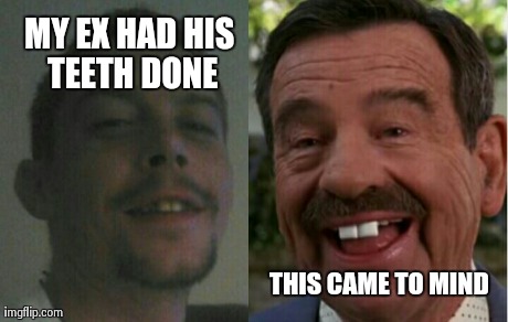 Bugs | MY EX HAD HIS TEETH DONE THIS CAME TO MIND | image tagged in teeth | made w/ Imgflip meme maker