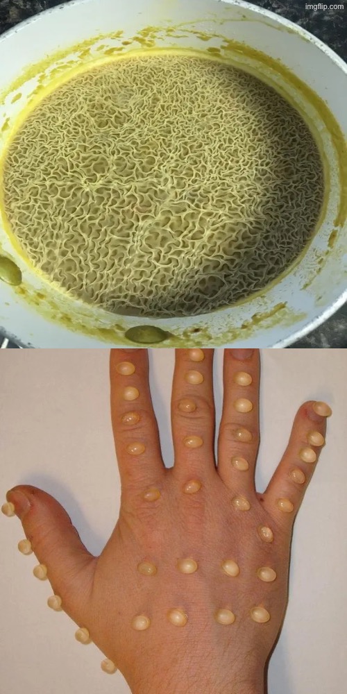 Bumps N Holes | image tagged in cursed images,what a terrible day to have eyes,phobia,holes,unsee juice,drink bleach | made w/ Imgflip meme maker