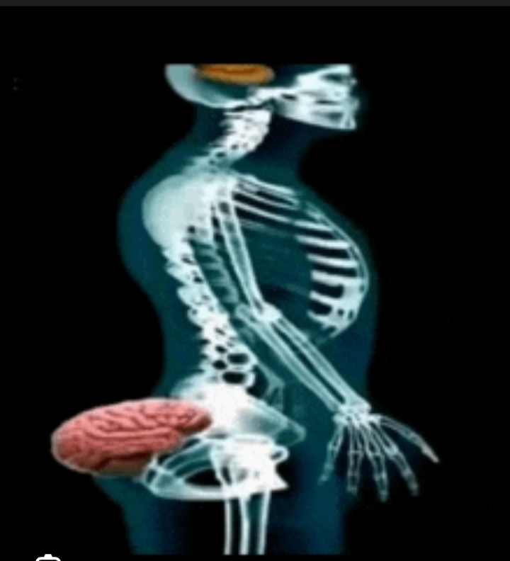 Dumb Blank Meme Template