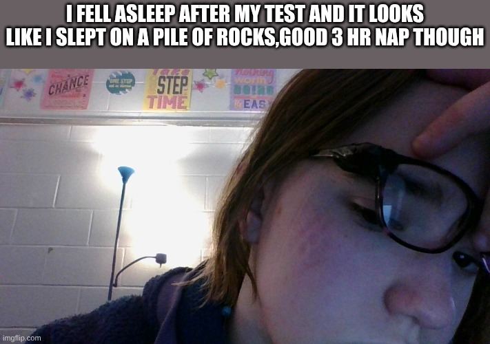 I fell asleep after my test and it looks like I slept on a pile of rocks,good 3 hr nap though | made w/ Imgflip meme maker