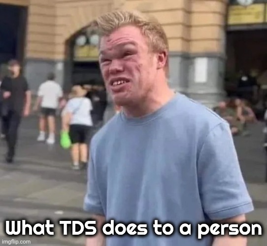 Creepy Irwin | What TDS does to a person | image tagged in creepy irwin | made w/ Imgflip meme maker