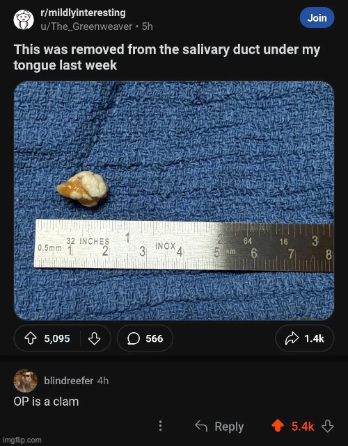 image tagged in reddit,op,clam,pearl | made w/ Imgflip meme maker