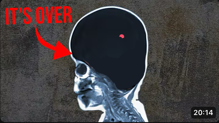 small brain Blank Meme Template