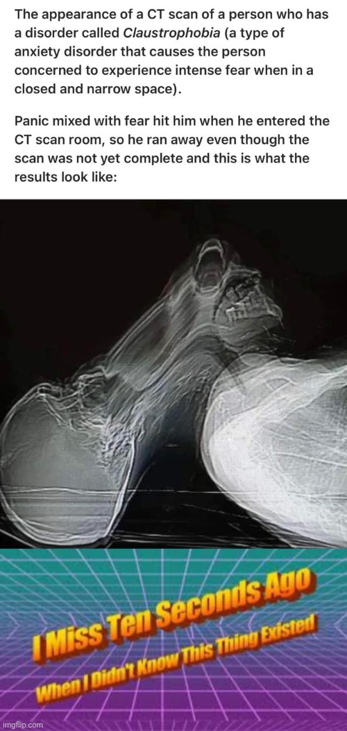 What, it's just claustrophobia OH MY GOODNESS | image tagged in i miss ten seconds ago | made w/ Imgflip meme maker