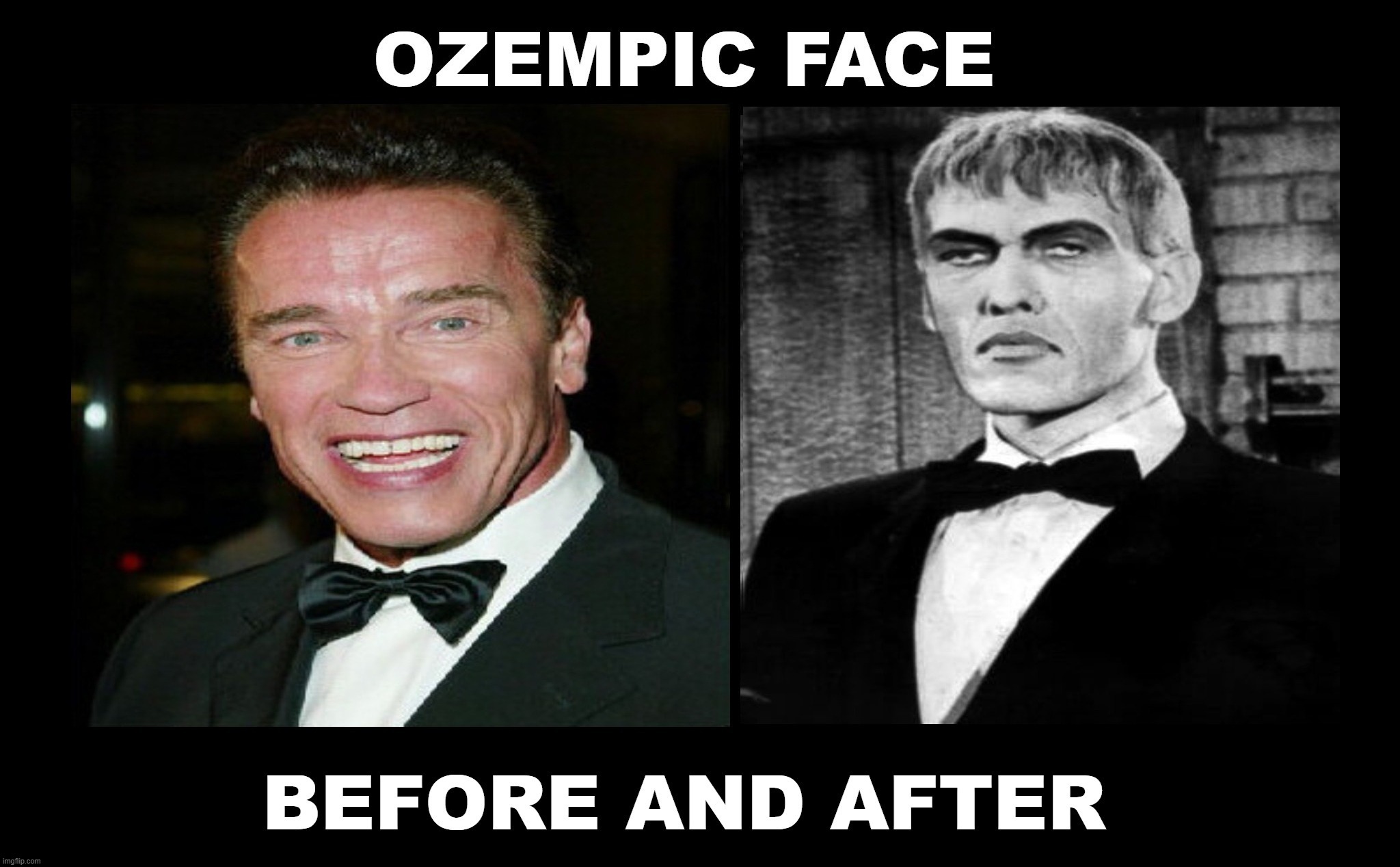 And Now You Know Why I Will NEVER Take Ozempic. | image tagged in ozempic,ozempic face,arnold schwarzenegger,lurch,addams family,ugly dude | made w/ Imgflip meme maker