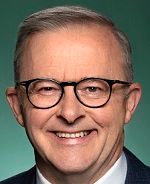 Anthony Albanese Smile Blank Meme Template