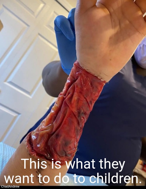 This is what they want to do to children. Child abuse is NOT funny and it is NOT a game. Quit using children as pawns. | This is what they want to do to children. | image tagged in transgender,mental illness,child abuse,democrats,liberals,leftists | made w/ Imgflip meme maker