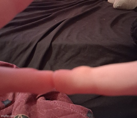 This is what traditional art (pencil+paper) does to you (yes that is a massive callus) | made w/ Imgflip meme maker