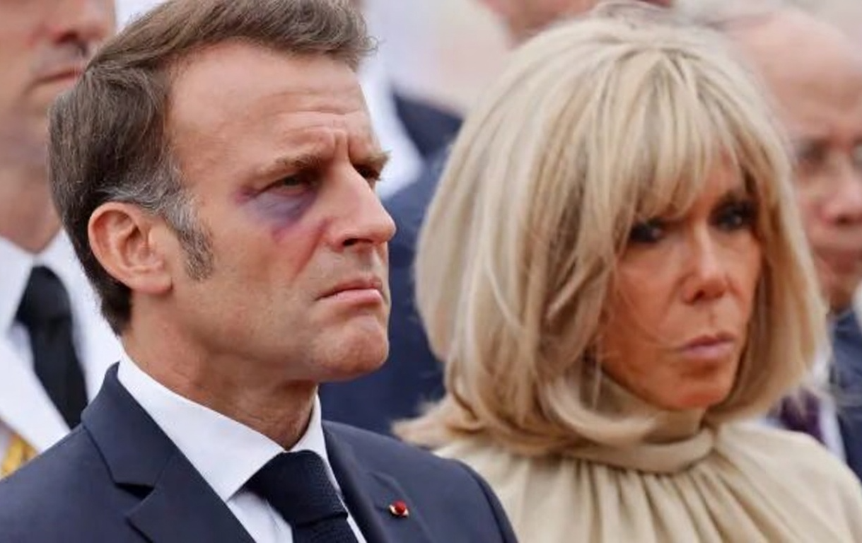 Emmanuel Macron with Black Eye Blank Meme Template