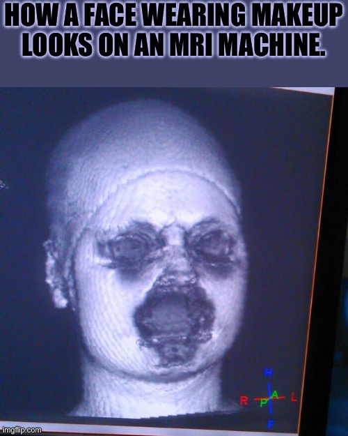 MRI's And Makeup | How a face wearing makeup looks on an MRI machine. | image tagged in cursed images,what a terrible day to have eyes,unsee juice,drink bleach,mri machine,beyond cursed | made w/ Imgflip meme maker
